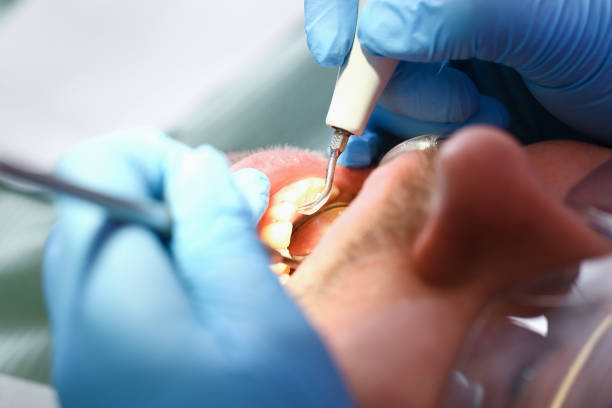 Best Mobile Emergency Dentist in Robert Lee, TX
